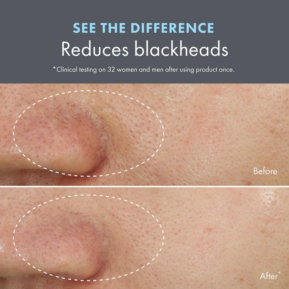 Clear Improvement™